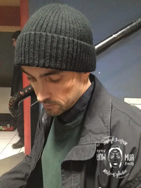 The scar