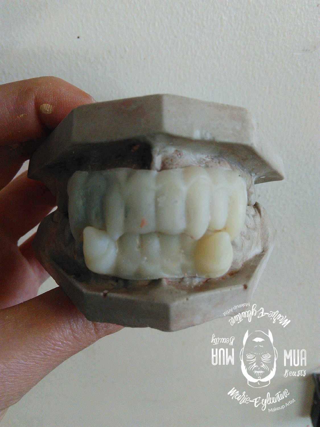 Moulage de dents et création d'un faux dentier. 